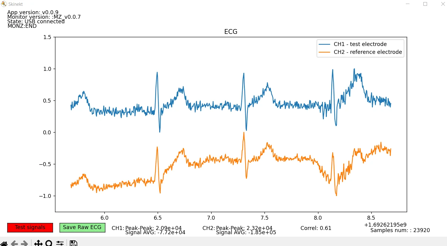 Dual-channel ECG software