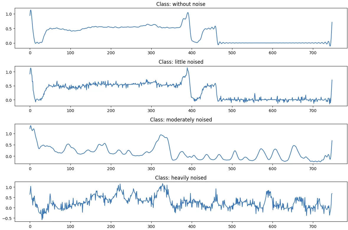 Edge AI na STM32 — klasifikace kvality EKG signálu